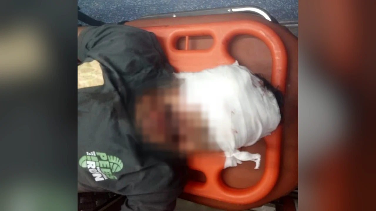 Injured man with a bandaged head on a stretcher after the Khurrianwala collision